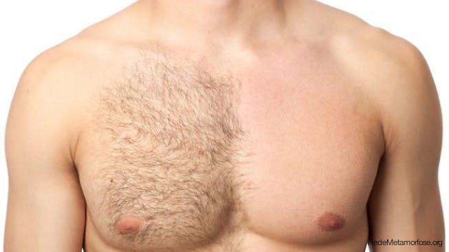 Do men need to shave?